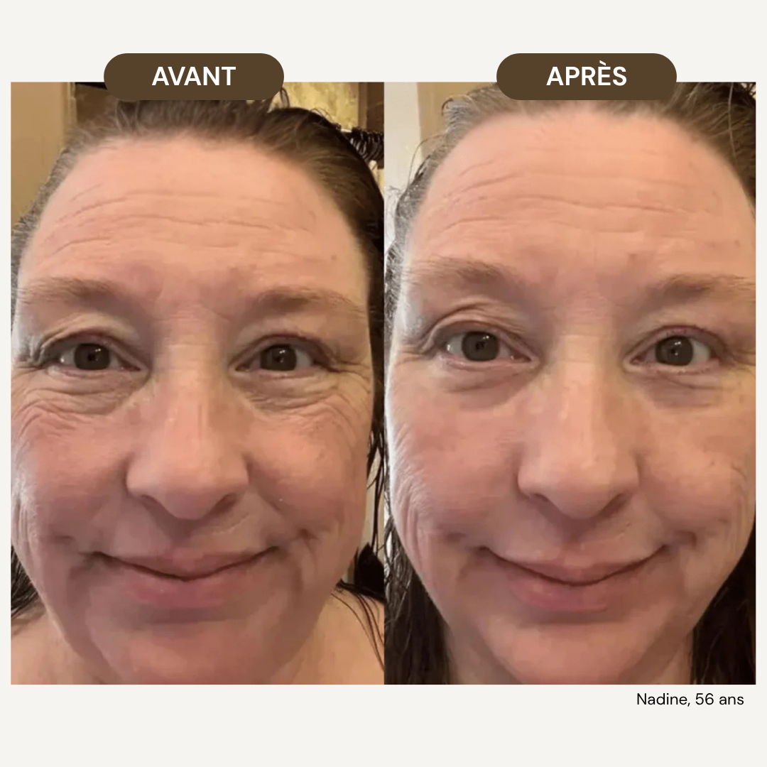 LiftPro™ - Brosse de drainage lymphatique