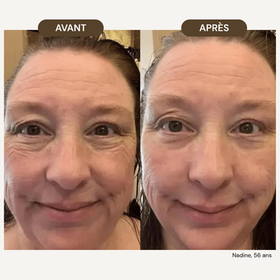 LiftPro™ - Brosse de drainage lymphatique