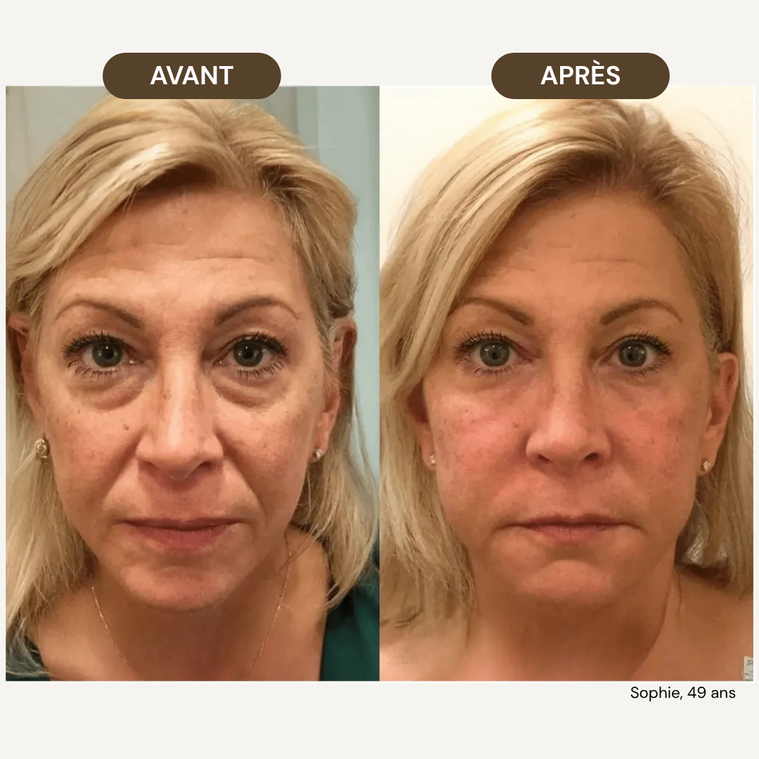 LiftPro™ - Brosse de drainage lymphatique