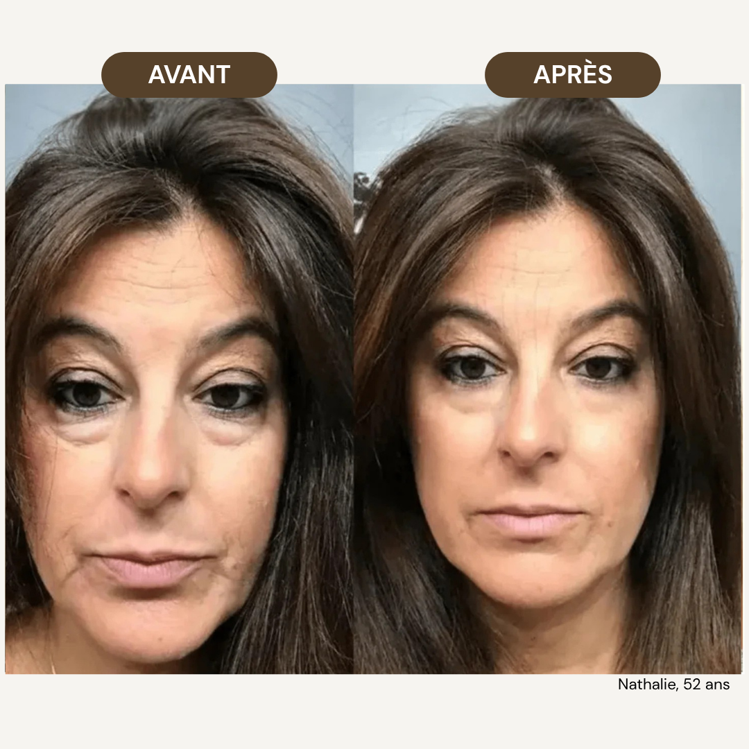 LiftPro™ - Brosse de drainage lymphatique